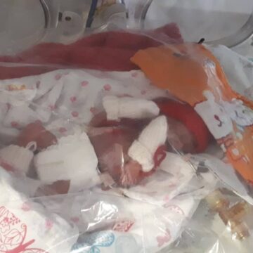EVELINA 22 savaitės 460 g - viena pirmųjų nuotraukų ligoninėje