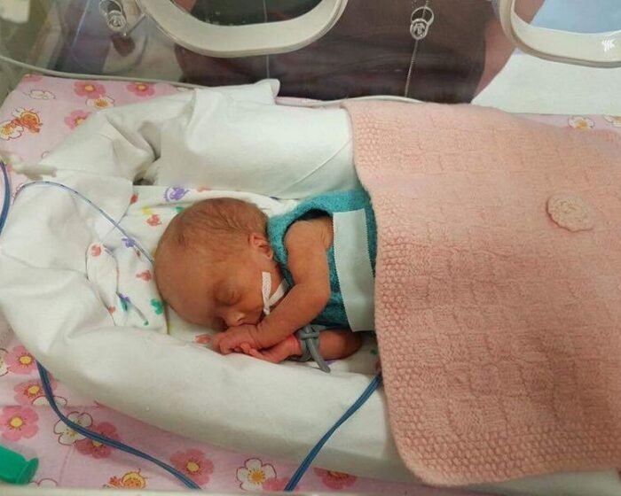 ADELĖ 29 savaitės 730 g - pirmosios akimirkos ligoninėje inkubatoriuje