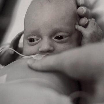 Paroda AŠ ČIA ketvirtoji nuotrauka su labai mažu neišnešiotuku