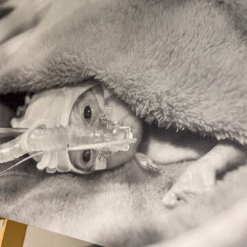 Paroda AŠ ČIA trečioji nuotrauka su labai mažu neišnešiotuku