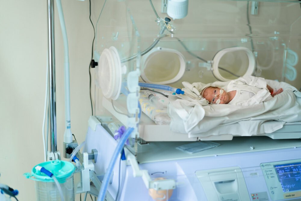 Newborn baby in a medical incubator connected to tubes and monitors.